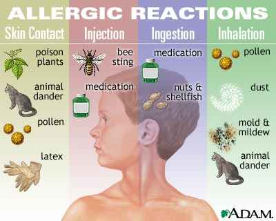 Аллергия